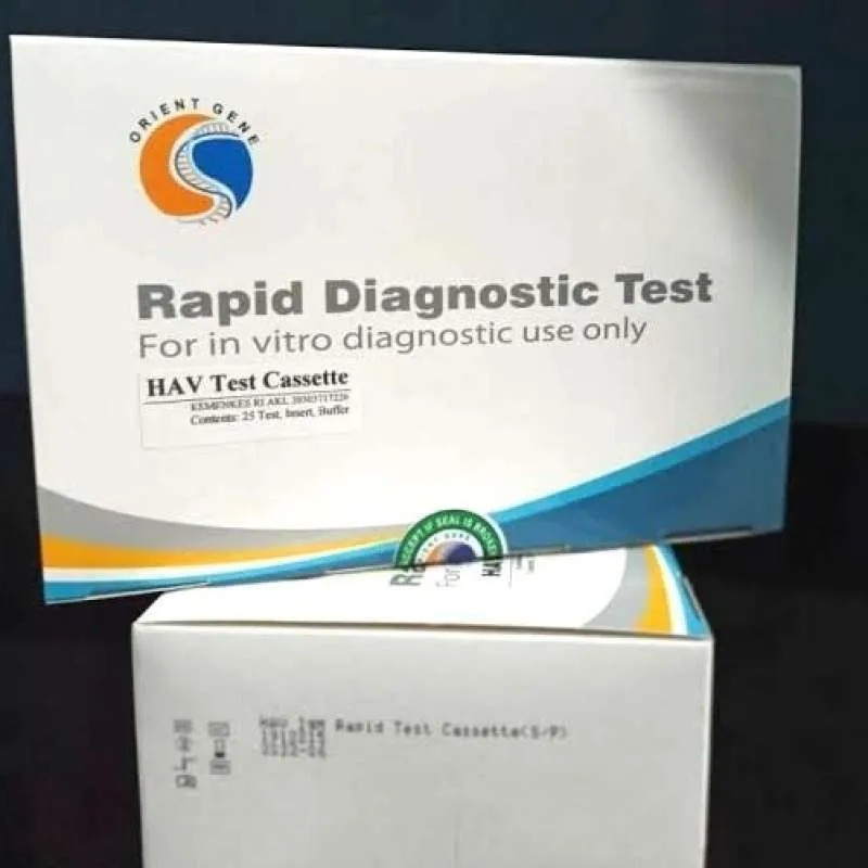 HAV(hepatitis A VIRUS RAPID TEST 25t)